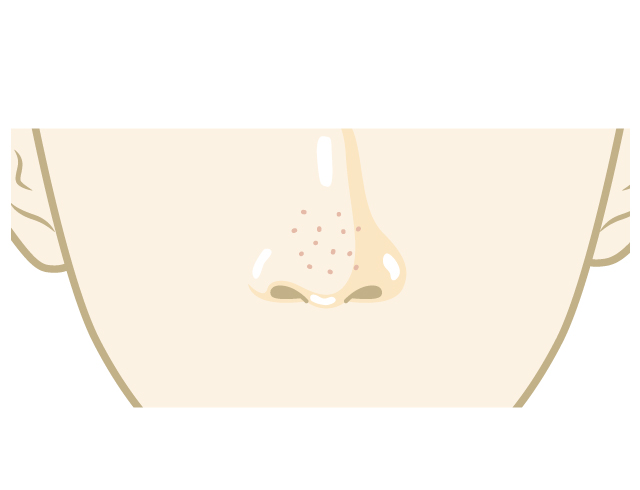 脂性肌で毛穴が目立つ鼻（イメージ）