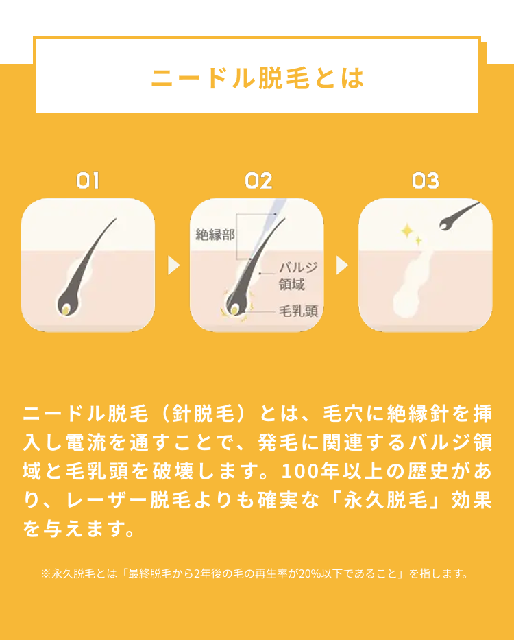 ニードル脱毛とは2