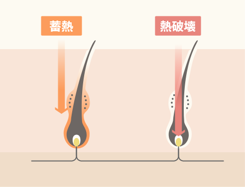 蓄熱式と熱破壊式の違い