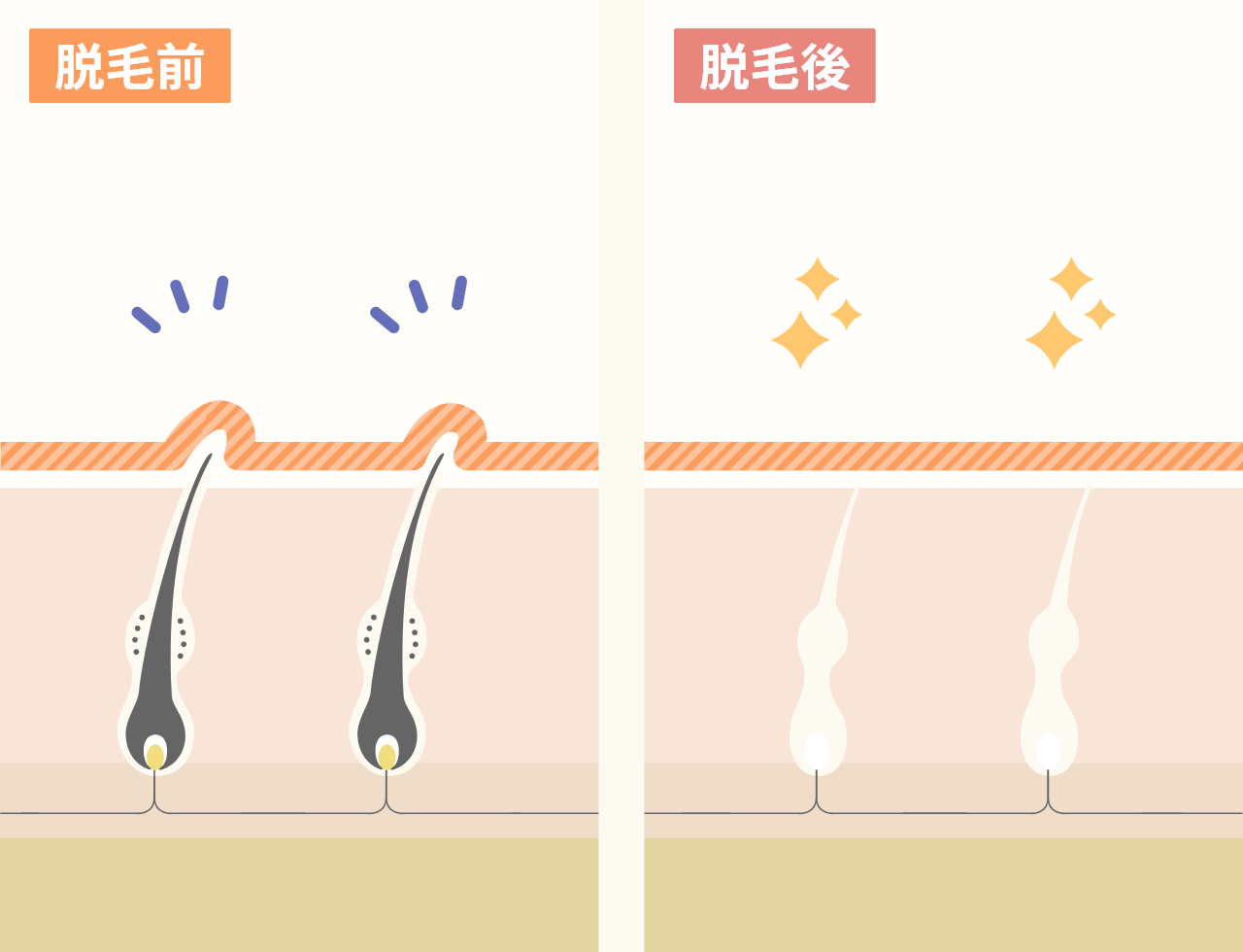 ほほの脱毛で、メイク乗りアップ。崩れも防止できます。