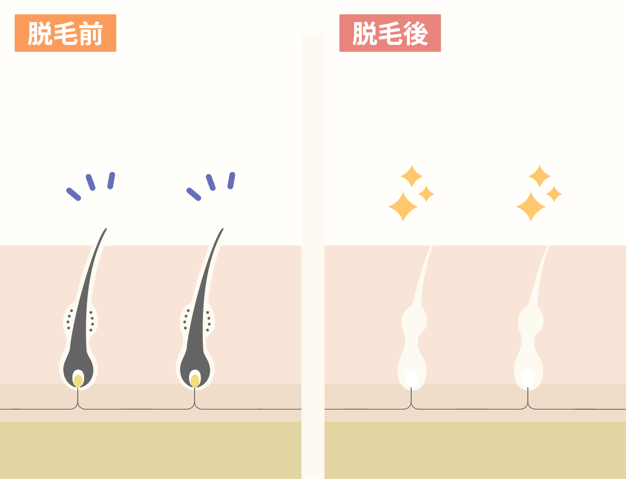 首の脱毛でメイク乗りアップ。崩れも防止できます。