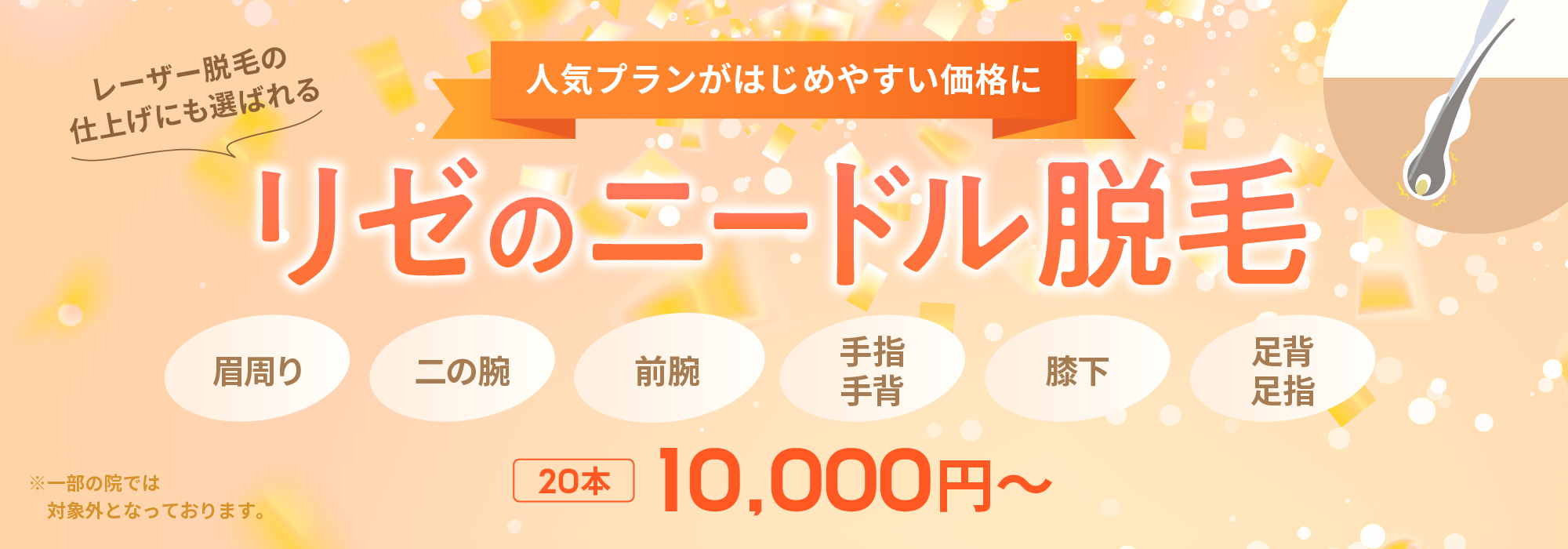 リゼのニードル脱毛