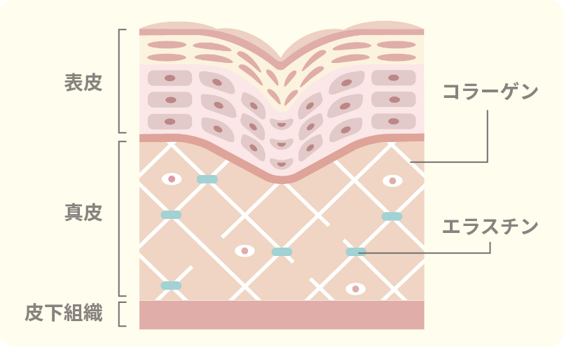 皮膚の弾力低下によるたるみイメージ