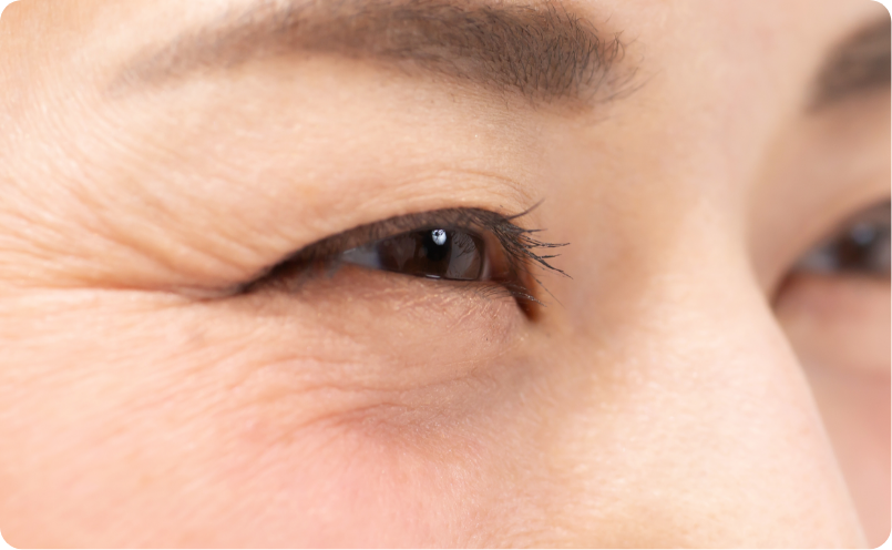 表情しわイメージ