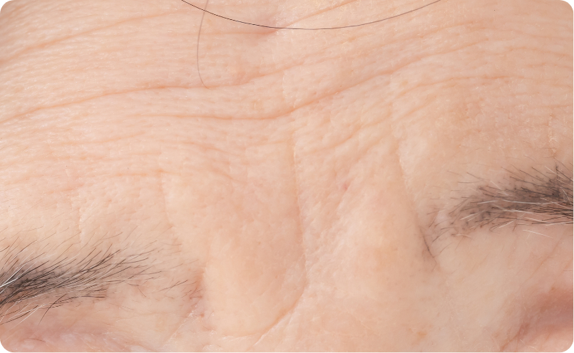 癖じわイメージ