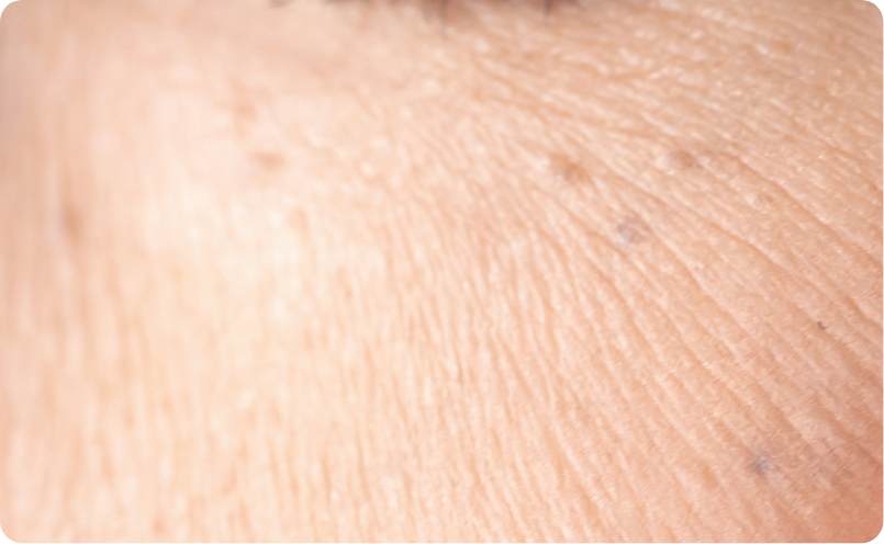 ちりめんじわイメージ