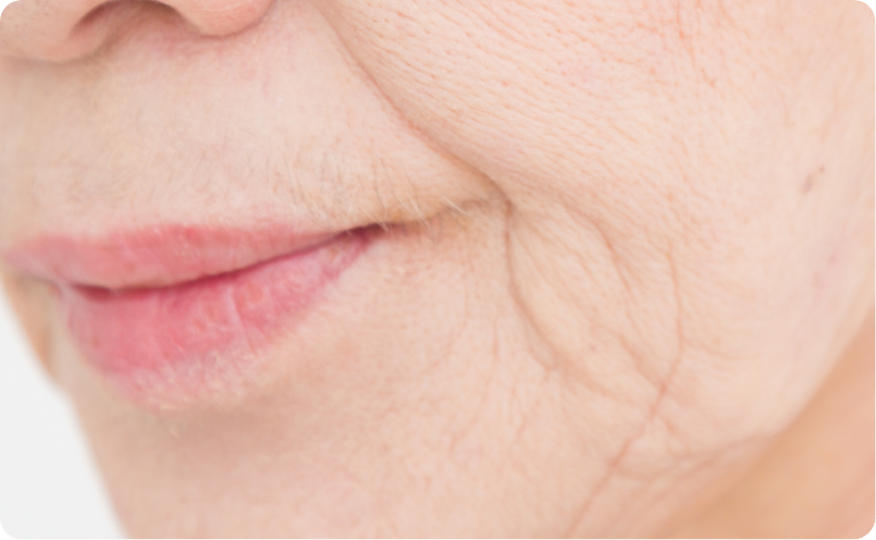 たるみしわイメージ