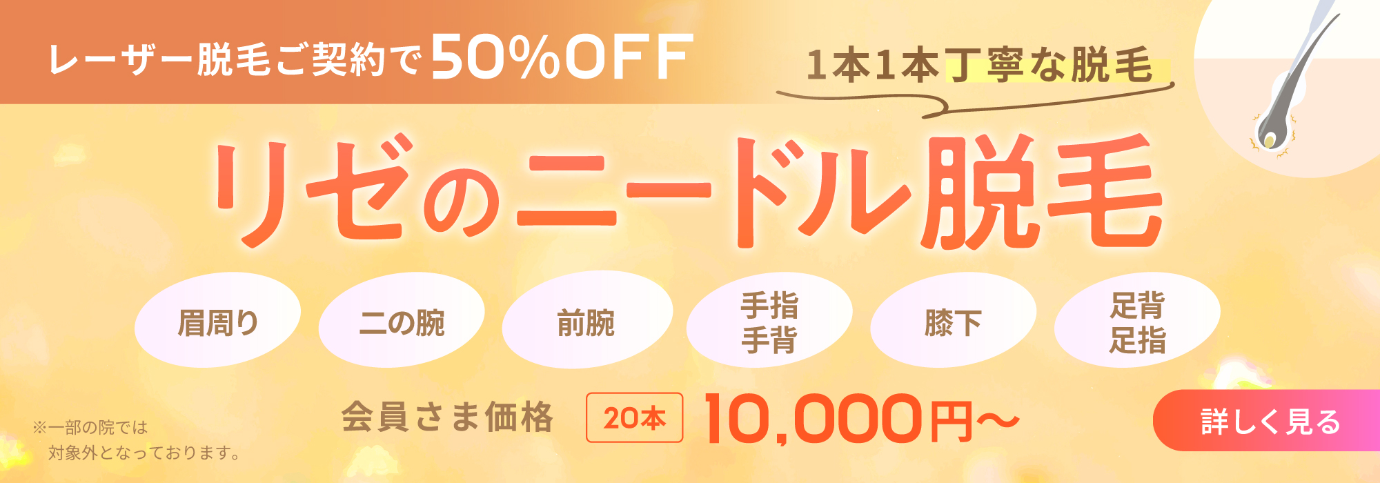 リゼのニードル脱毛