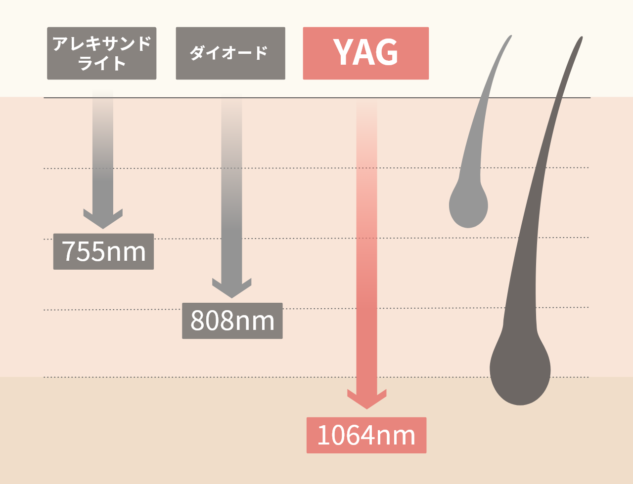 濃く太い⽑も、⾊素沈着も、あらゆる部位を脱⽑可能。