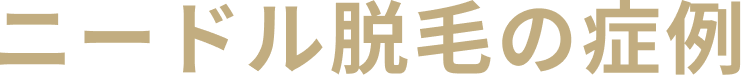 ニードル脱毛の症例