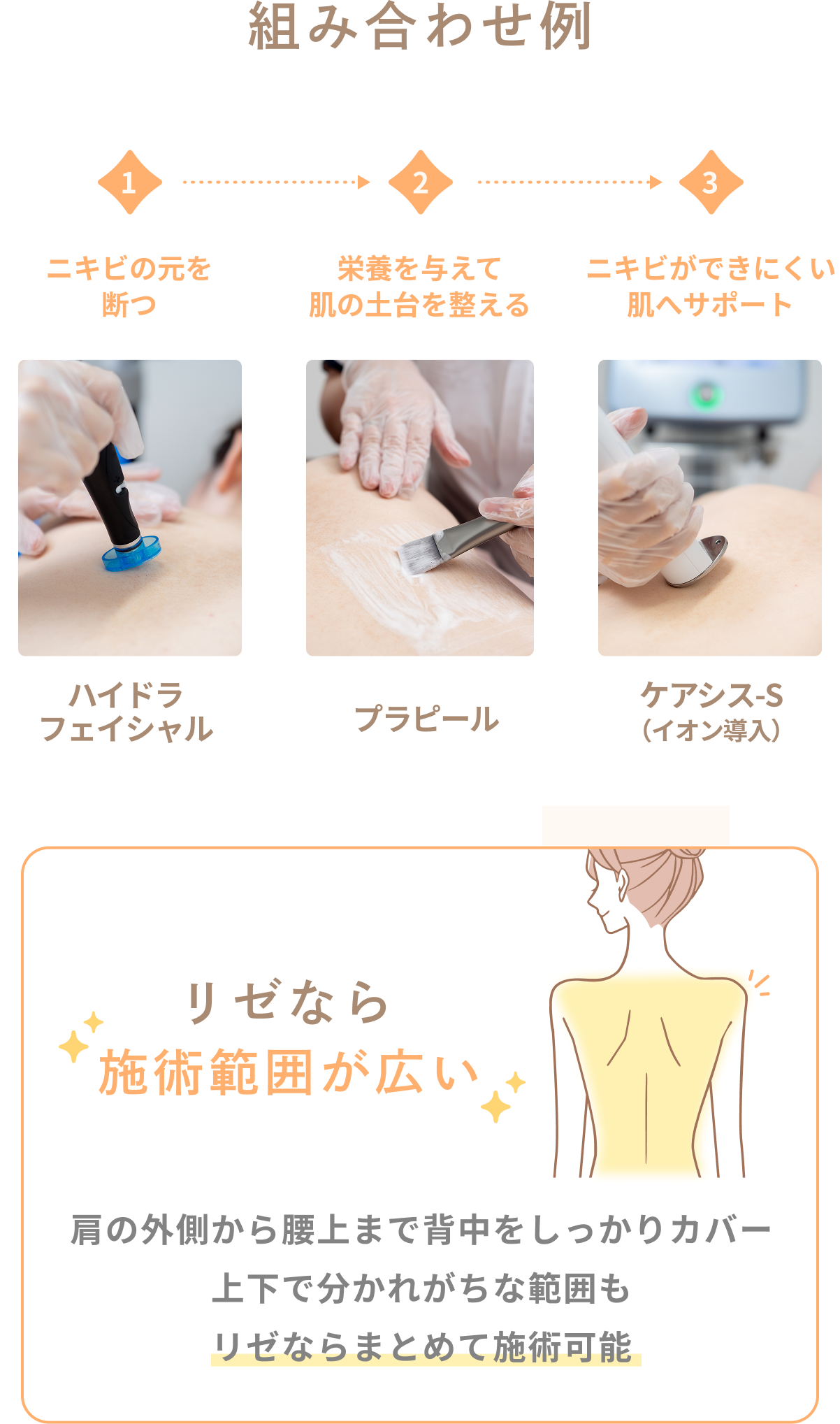 肌を隠すための服選びはもう終わり