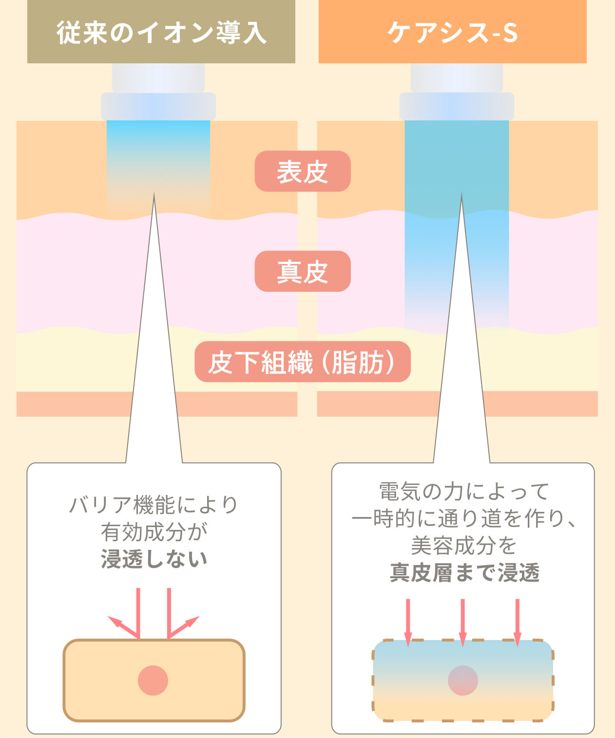 ケアシス-Sの比較画像