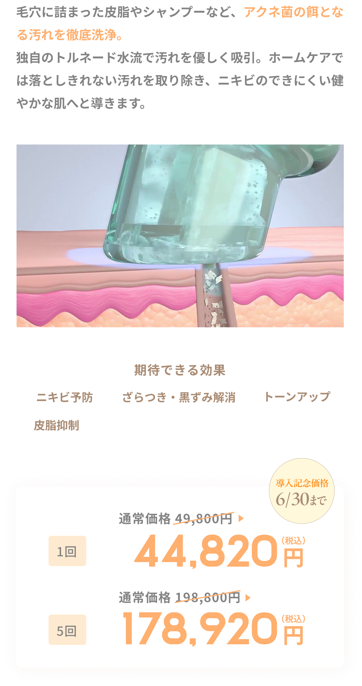 ハイドラフェイシャル