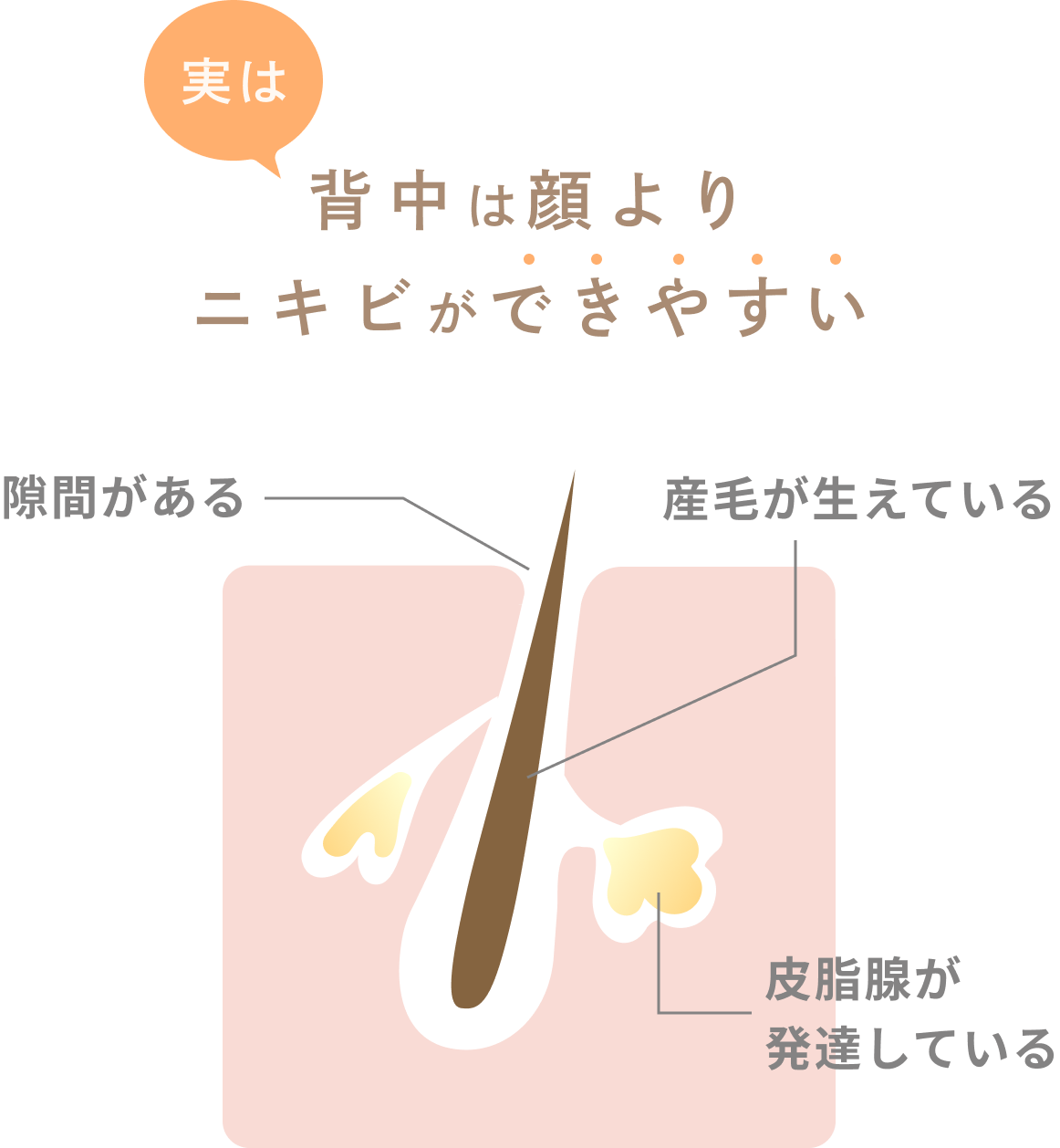 背中は顔よりニキビができやすい
