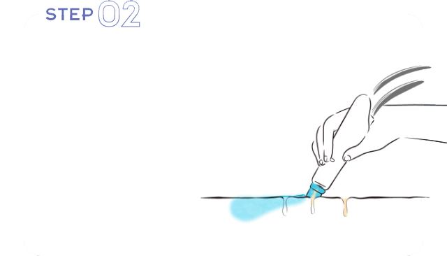 STEP2
