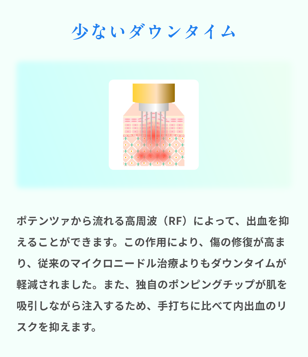 少ないダウンタイム