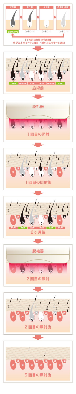 1回で感じる効果はどのようなものでしょうか 医療脱毛専門のリゼクリニック