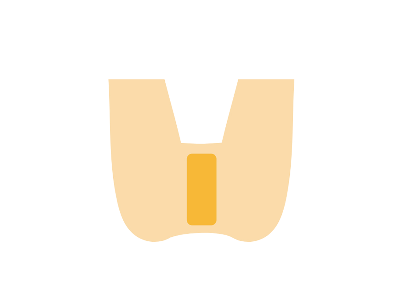 Iラインの自己処理方法