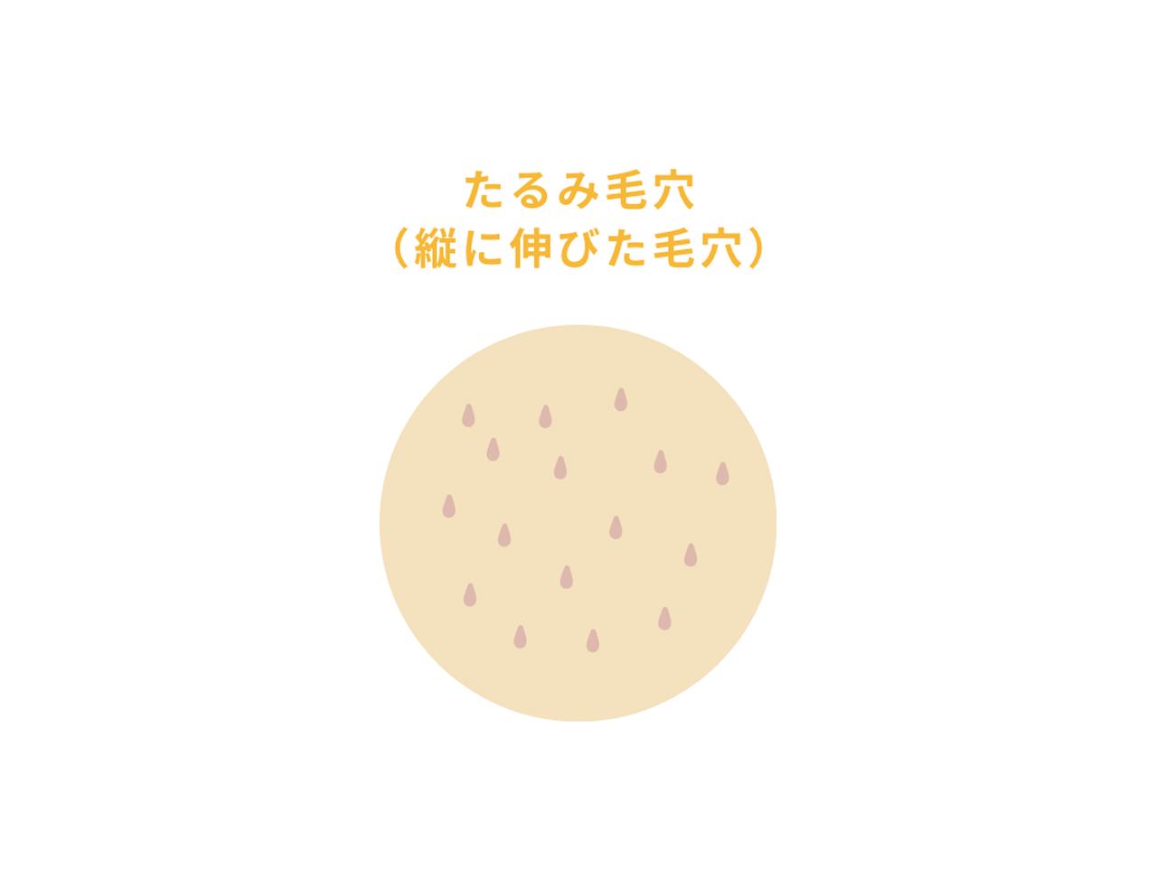 たるみ毛穴