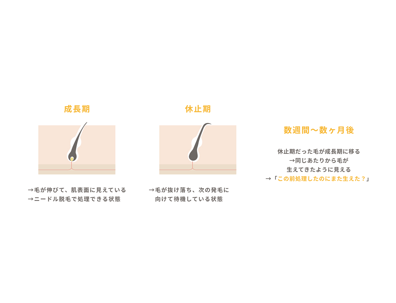 毛が再び生えてきたように見える仕組み