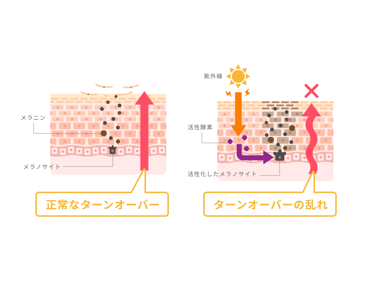色素沈着