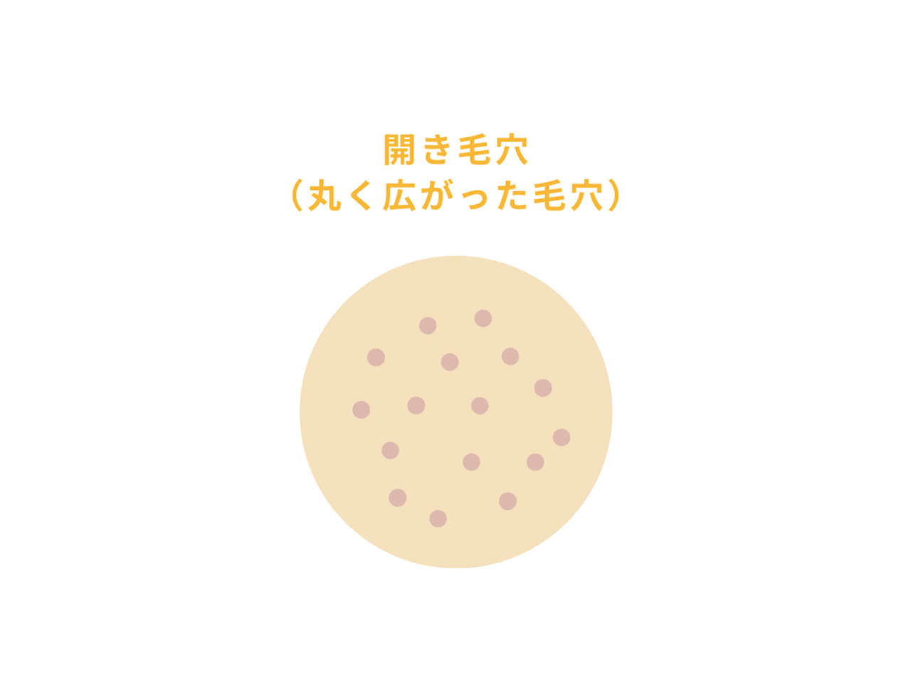開き毛穴