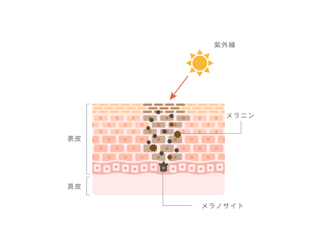 日焼けしているとやけどのリスクが高まる理由