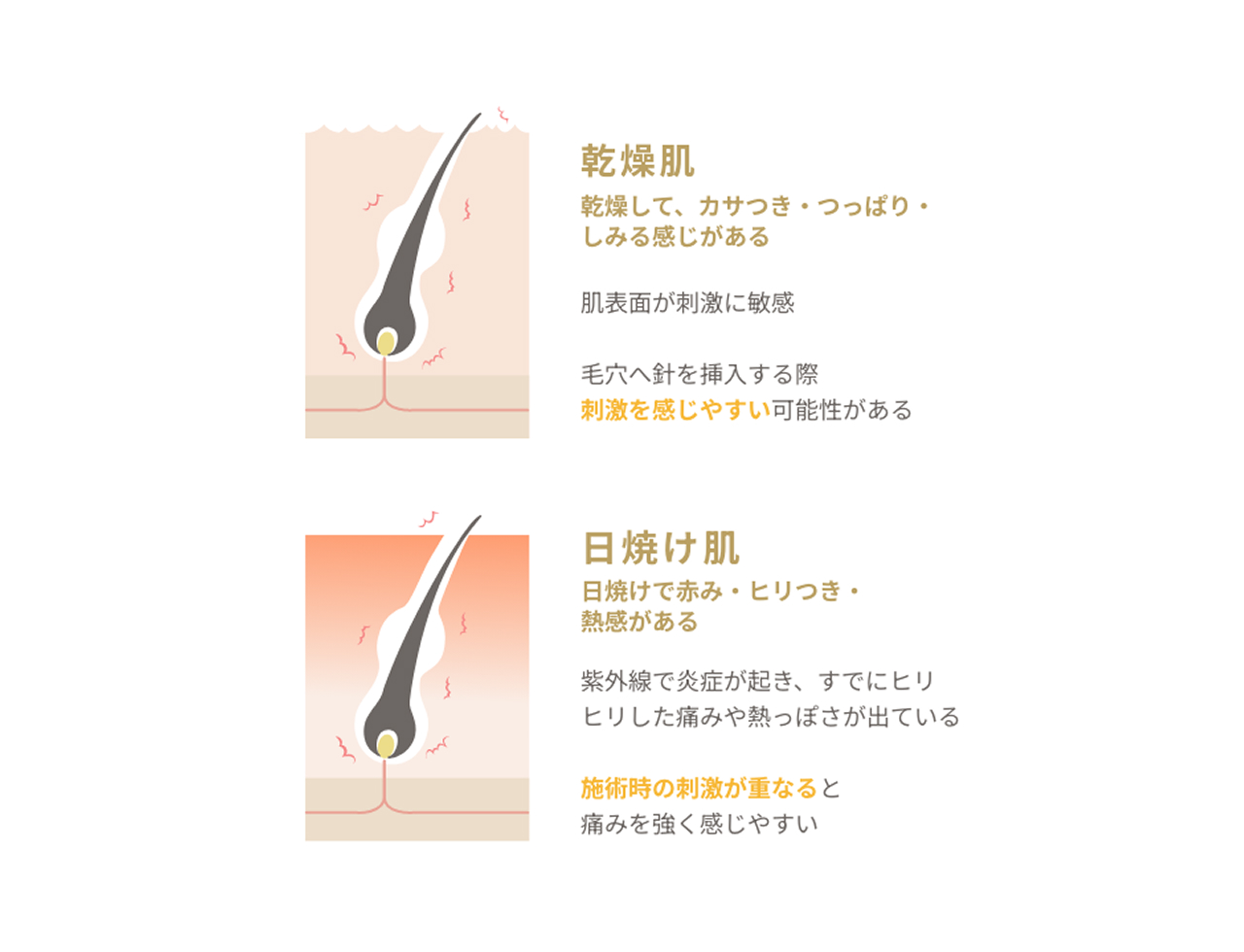 乾燥肌や日焼け肌の人
