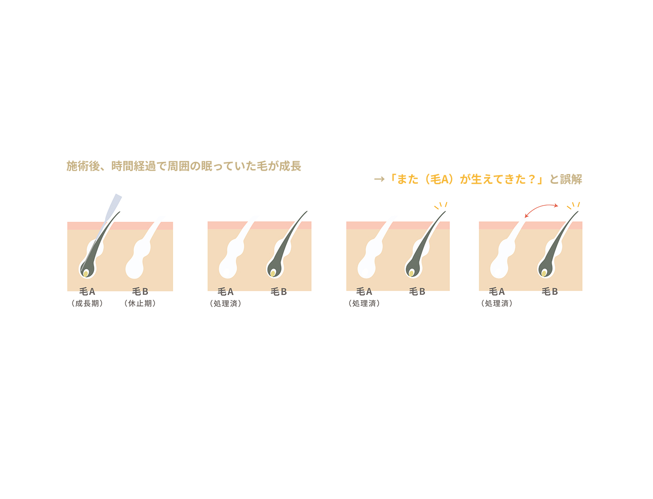 2.施術した毛の周辺に眠っていた毛が生え、復活したように見えた