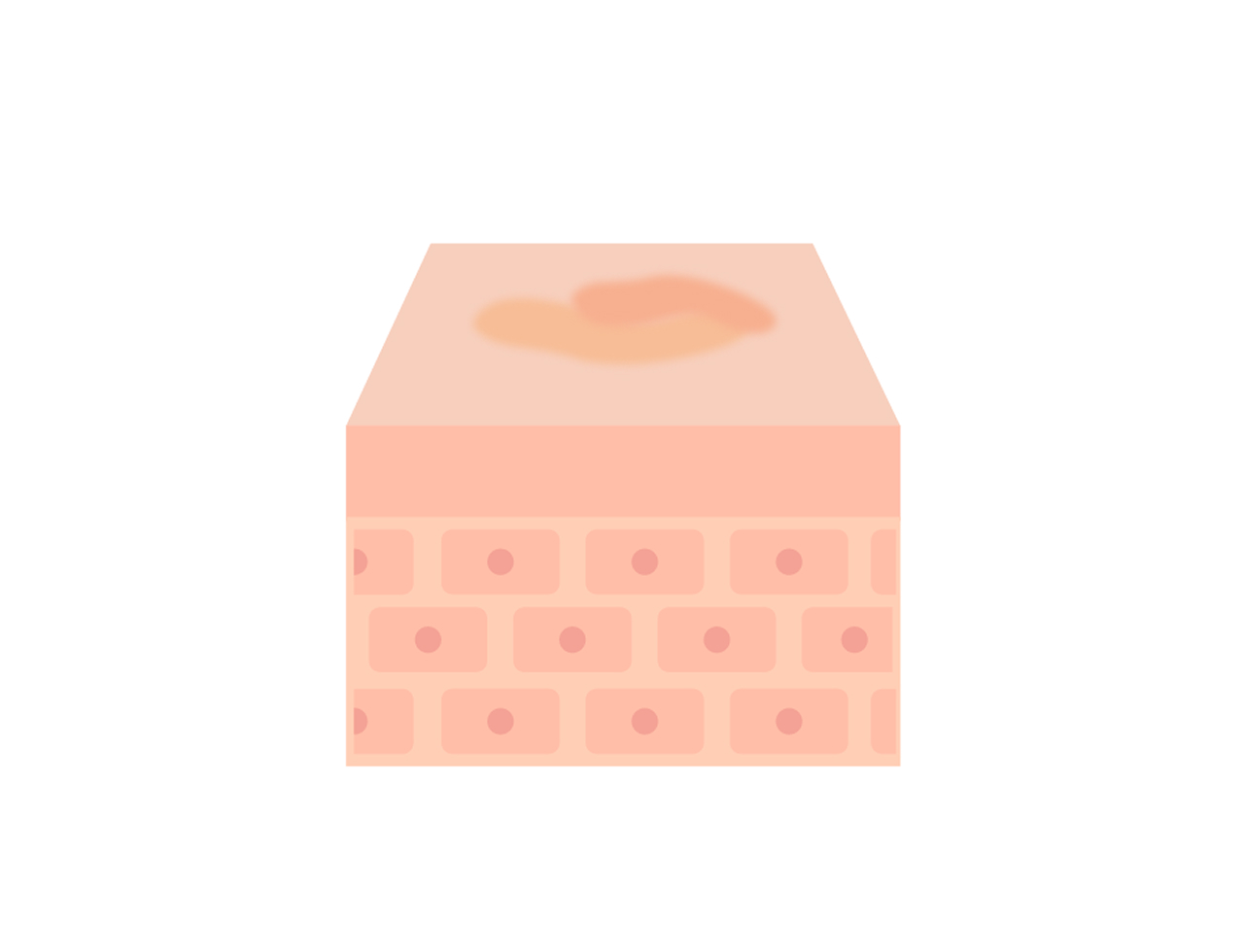 瘢痕（はんこん）
