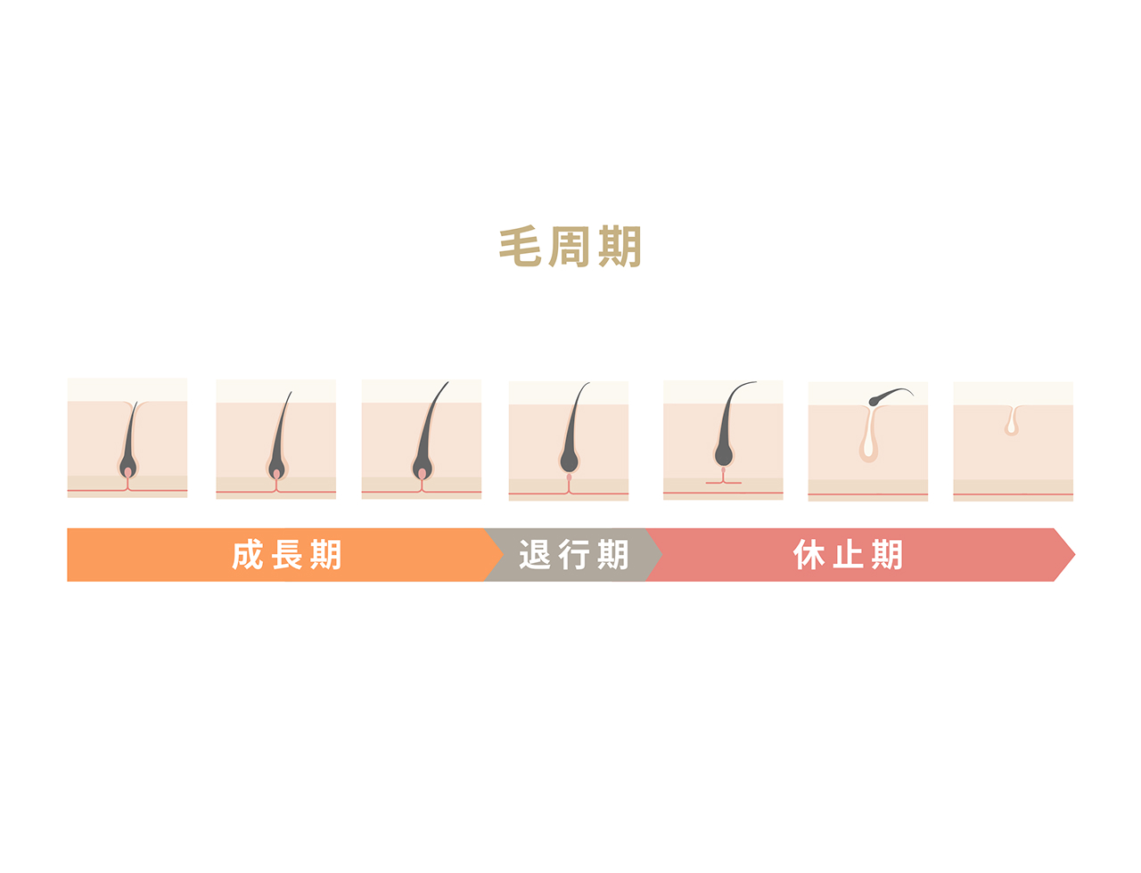 硬毛化の不安解消ガイド|脱毛後の発生率から予防策まで