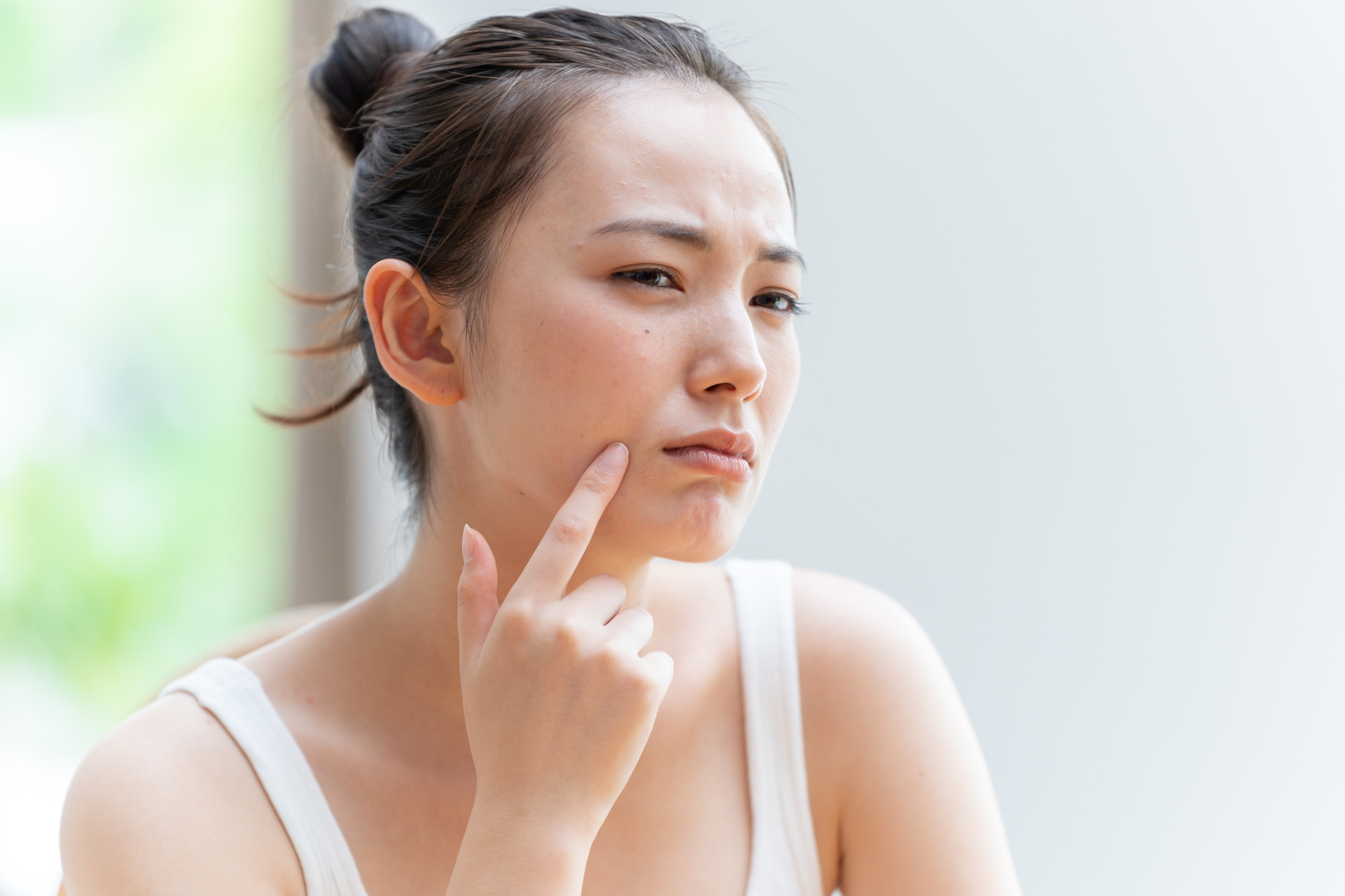 ニキビがあっても顔脱毛できる場合あり!見極め方を解説